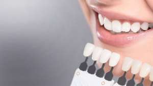 Изображение объявления 1. Отбеливание зубов в клинике Эстет Смайл аппаратом Beyond